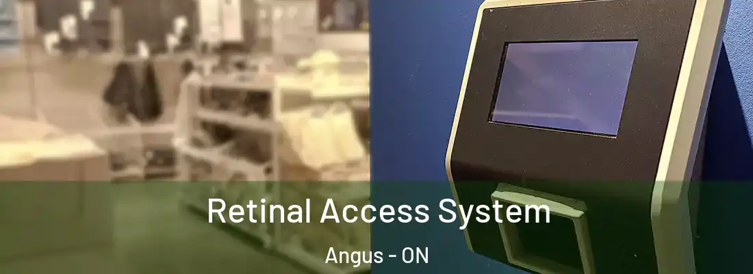  Retinal Access System Angus - ON