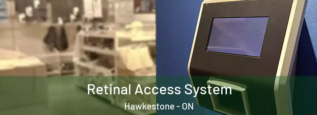  Retinal Access System Hawkestone - ON