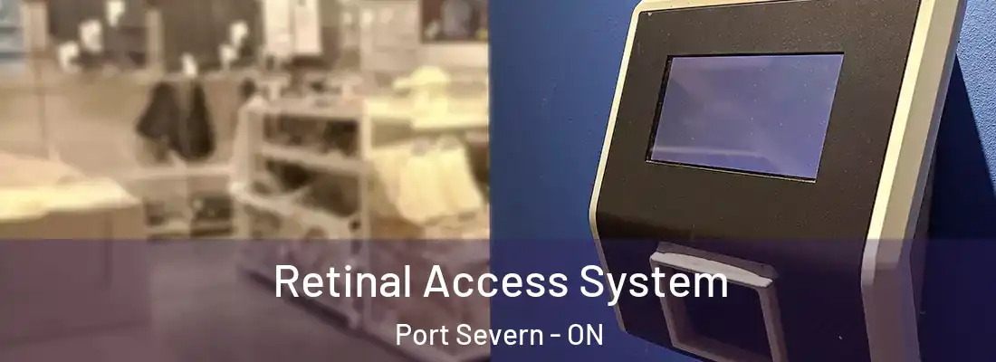  Retinal Access System Port Severn - ON